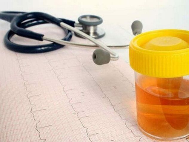 analýza moči k diagnostice cystitidy